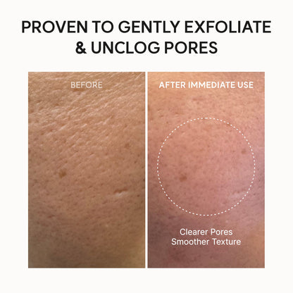 Vaseiko™ Korean Rice Mochi Face Cleanser
